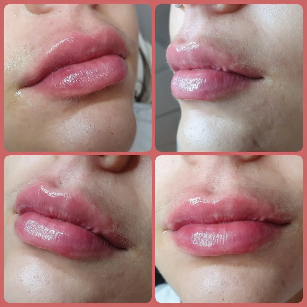 Images Lincoln Aesthetic