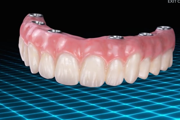 Images Northeast Lincoln Family Dentistry