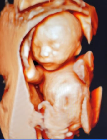 Images Love At First Sight 3D/4D Ultrasound Imaging Studio, LLC