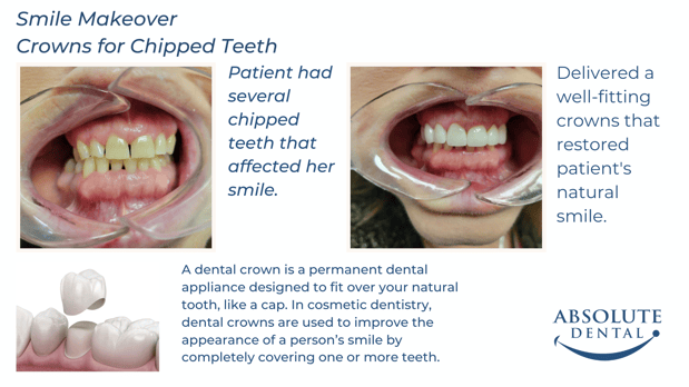 Images Absolute Dental