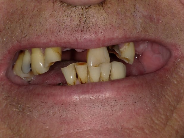 Images SmileCare Dental