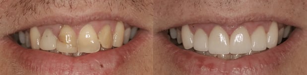 Images Iroquois Dentistry