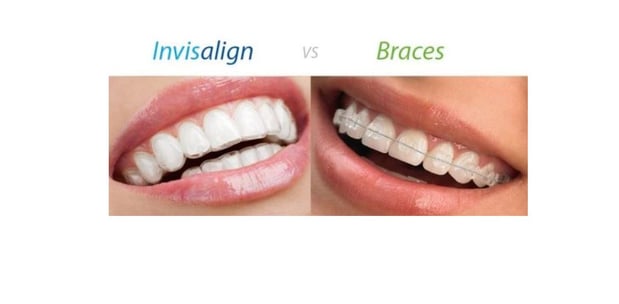 Images Lincoln Family Dentistry