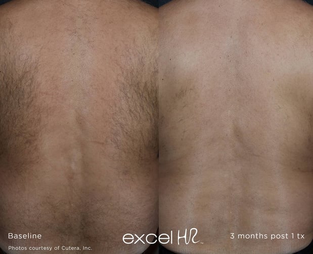 Images Celtic Spa & Laser Services