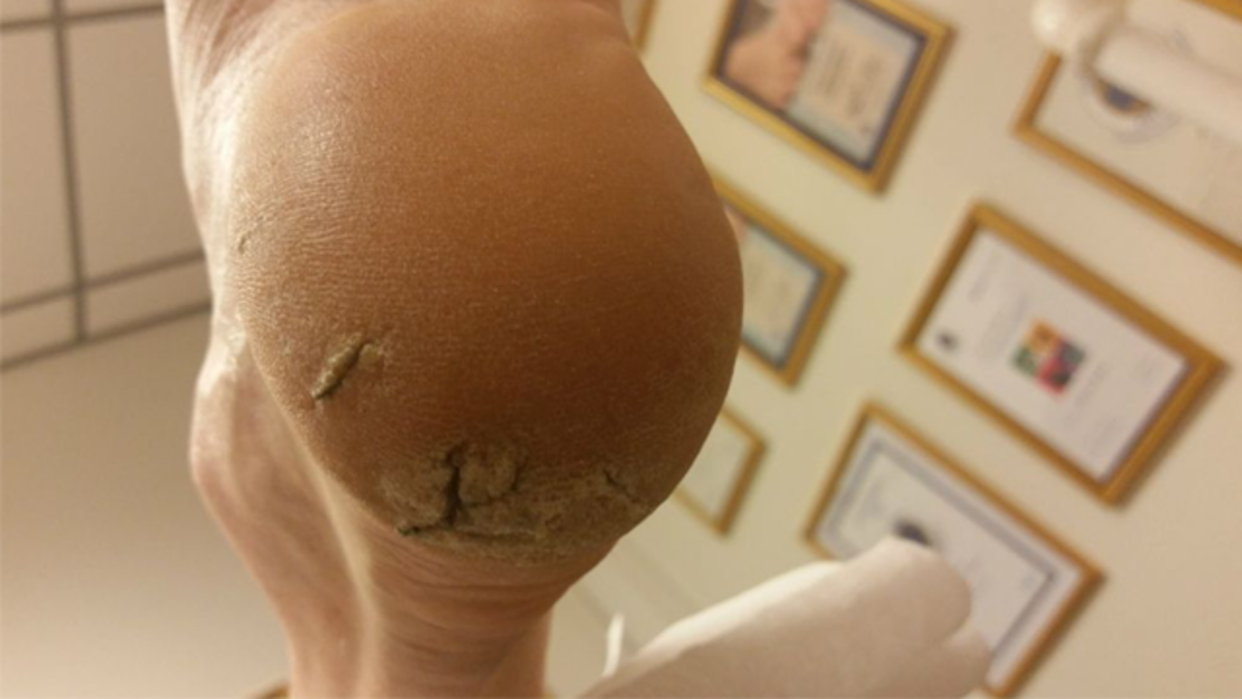 Images Kongsberg Fotterapi AS