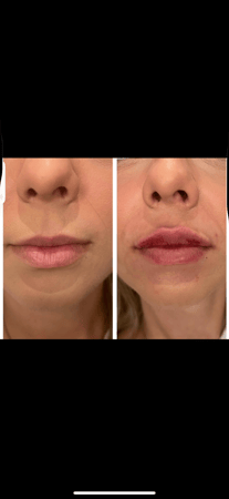 Images Body Lounge Park Cities - Whole Body Wellness & Medical Aesthetics, Dallas, TX