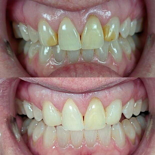 Images South Weber Dental