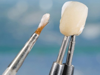 Bilder Dentaltechnik G. Stutzer