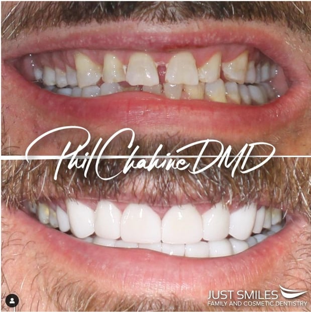 Images Just Smiles - General, Cosmetic & Implant Dentistry