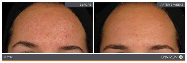 Images Celtic Spa & Laser Services