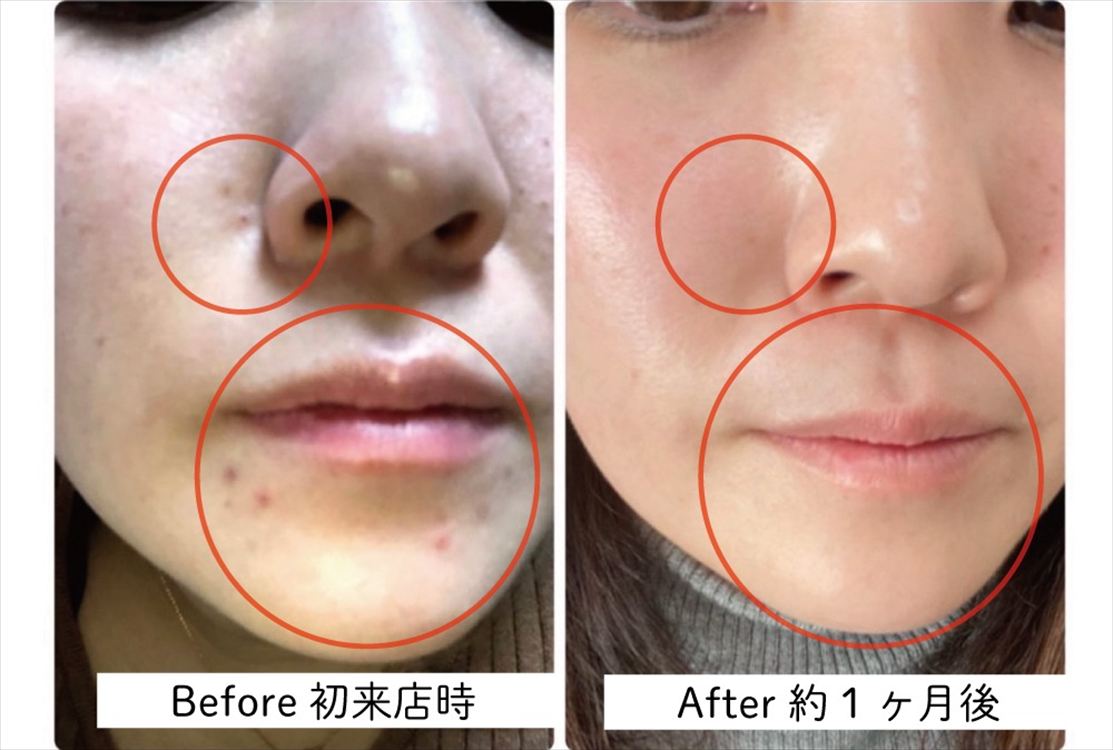 Images 肌質改善サロンサルヴァトーレ長崎