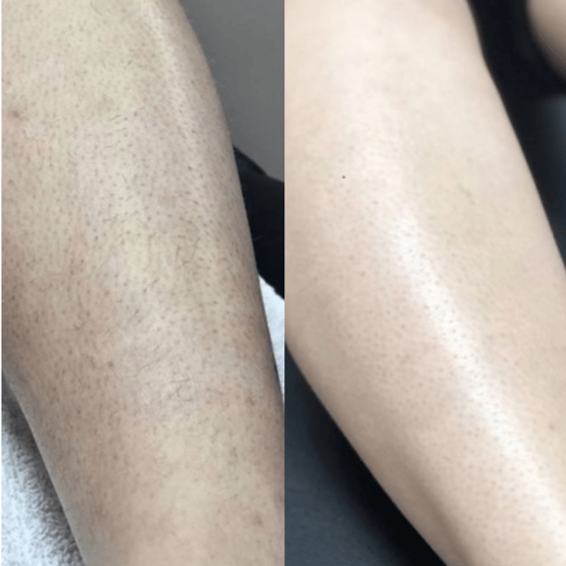 Images Cedar Grove Aesthetics