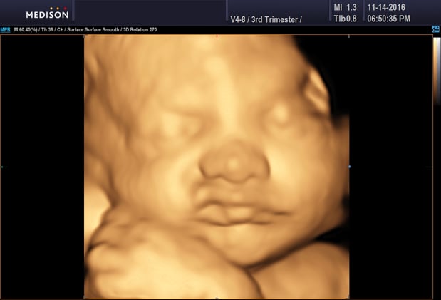 Images Heavenly 3D 4D Ultrasounds
