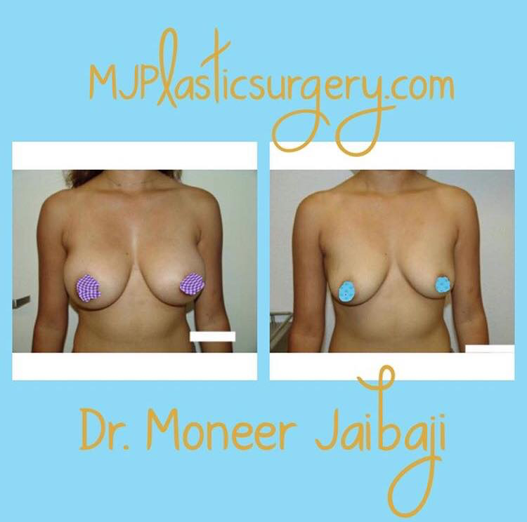 Jaibaji Plastic Surgery Photo