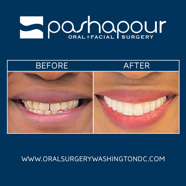 Images Pashapour Oral + Facial Surgery