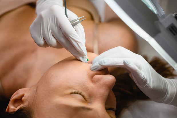 Images Naked Beauty Electrolysis