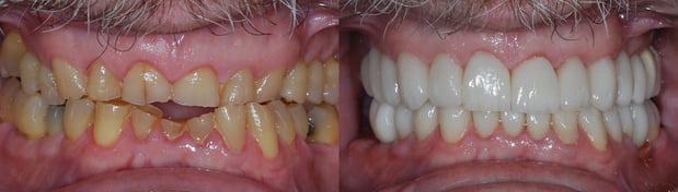 Images Today's Dental Care
