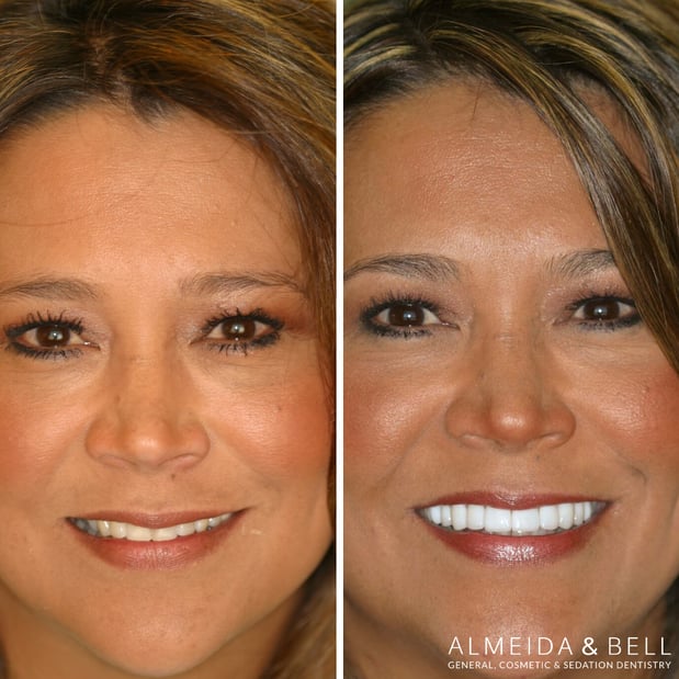 Images Almeida & Bell Dental Lone Tree - General, Cosmetic, and Implant Dentistry