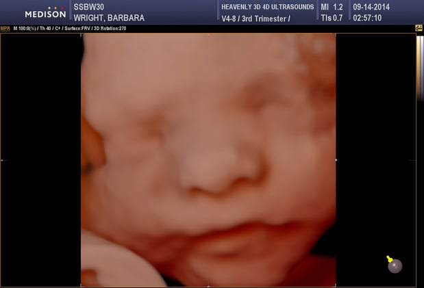 Images Heavenly 3D 4D Ultrasounds-Upland