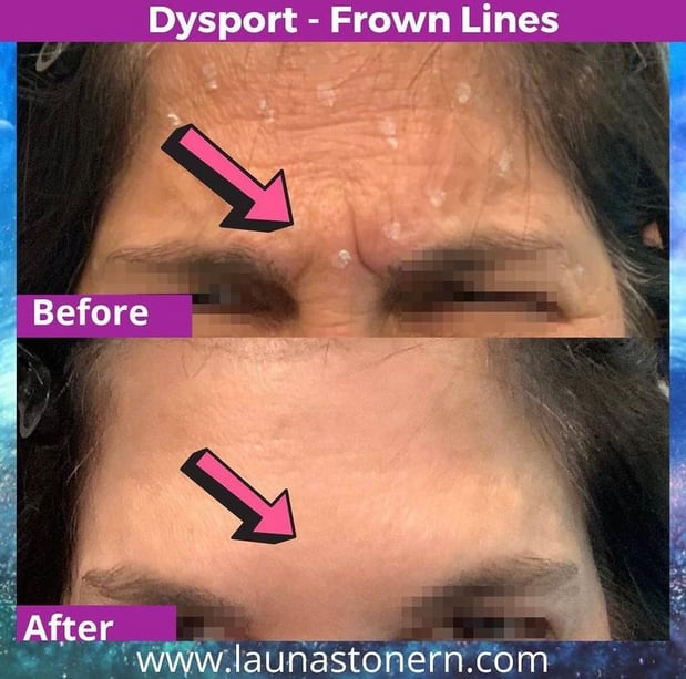 Images Launa Stone, R.N.