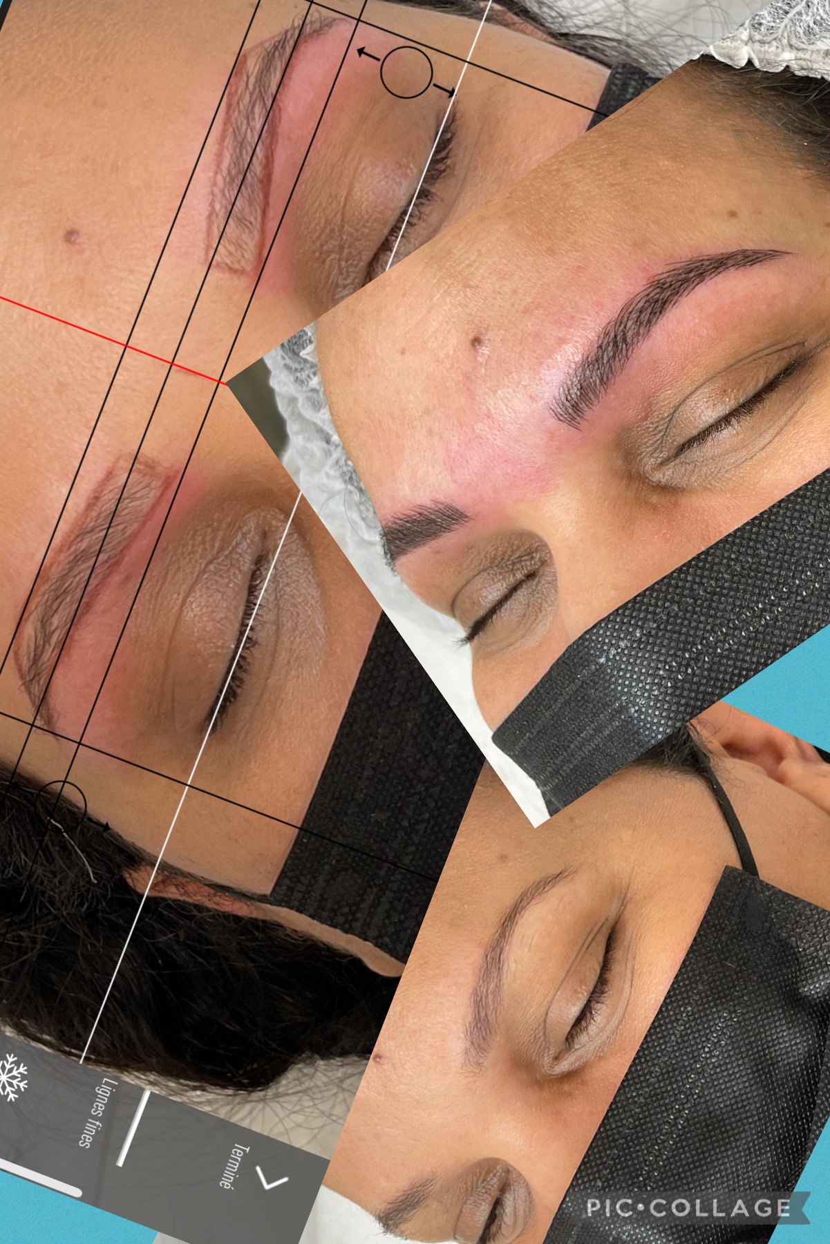 Images Clinique d'Esthétique Leila - Hydrafacial, Microblading, Épilation Laser Sainte-Foy