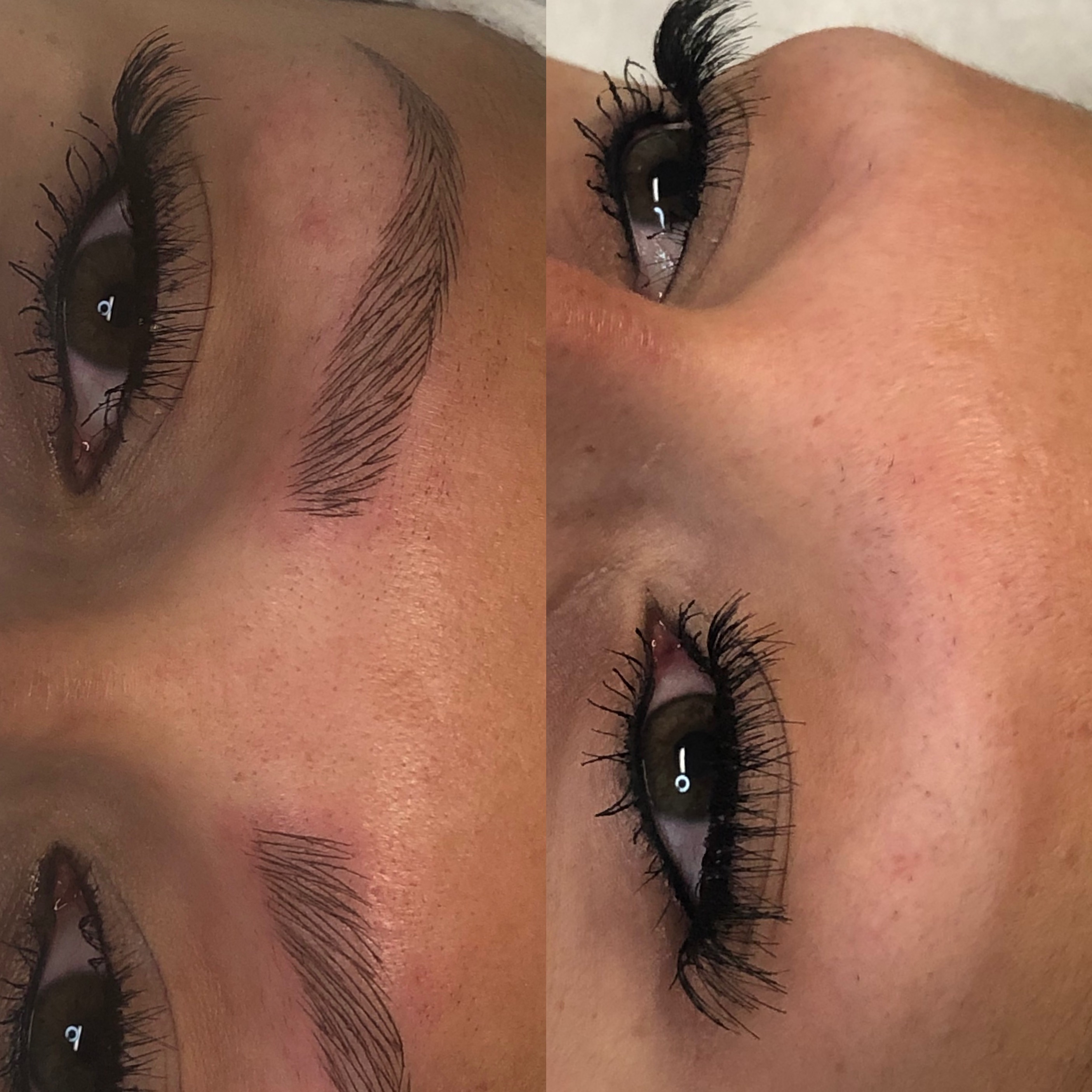 Images Clinique d'Esthétique Leila - Hydrafacial, Microblading, Épilation Laser Sainte-Foy