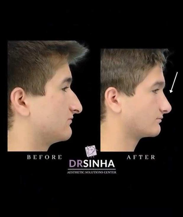 Images Pradeep K Sinha MD PhD FACS - Facial Aesthetic Surgery