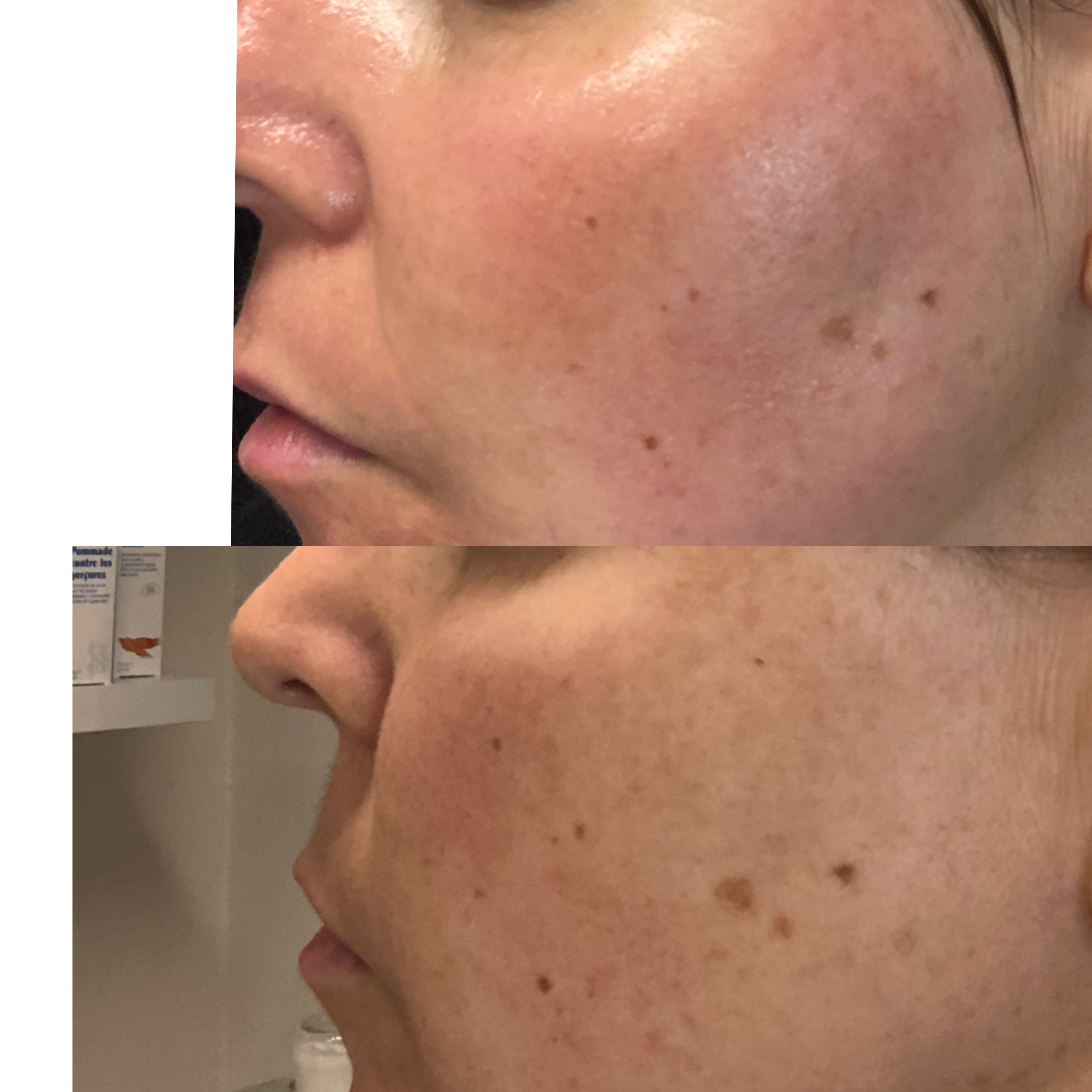 Images Clinique d'Esthétique Leila - Hydrafacial, Microblading, Épilation Laser Sainte-Foy