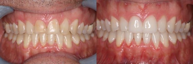 Images Campbell Dental Arts