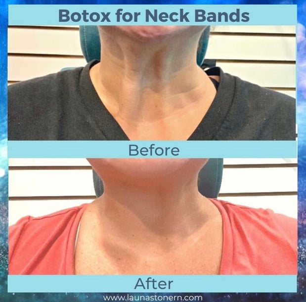 Images Launa Stone, R.N.