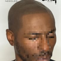 Images The Scalp Master