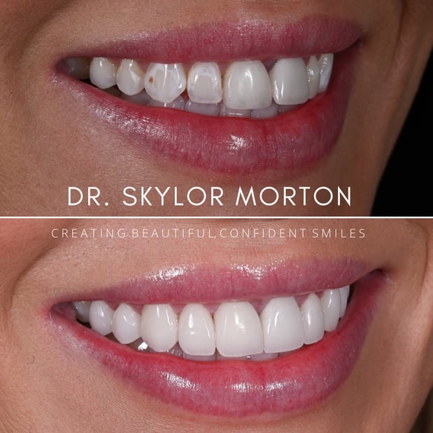 Images Nashville Wisdom Teeth and Implant Solutions