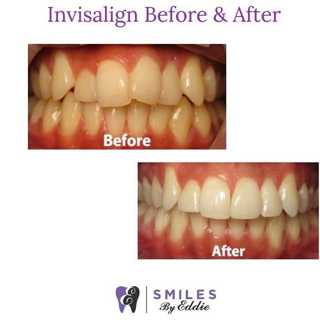 Images Smiles By Eddie: Dr. Edmond Ahdoot DDS