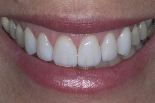 Images Vero Beach Art of Dentistry