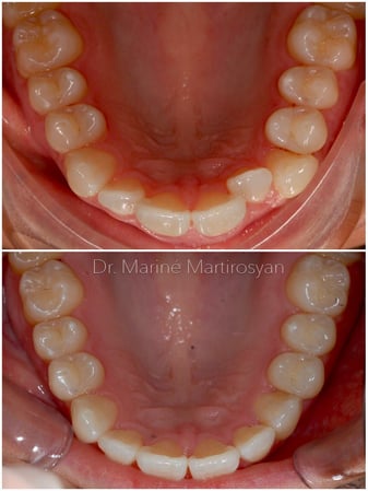 Images Pacific Dental Care