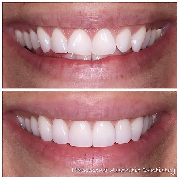 Images Hammond Aesthetic & General Dentistry