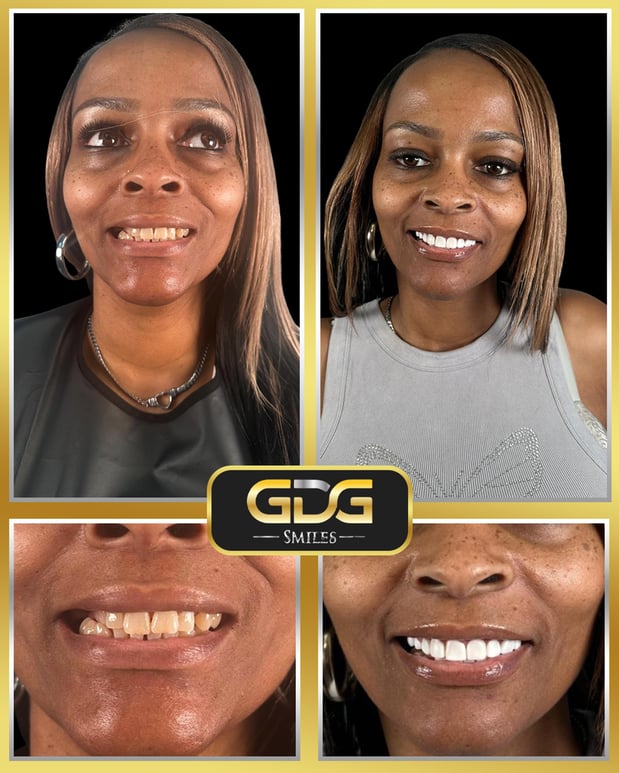 Images GDG Smiles