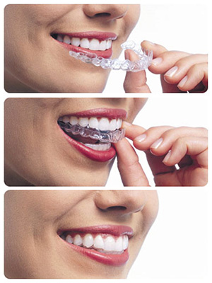 Images Vitangeli Dental