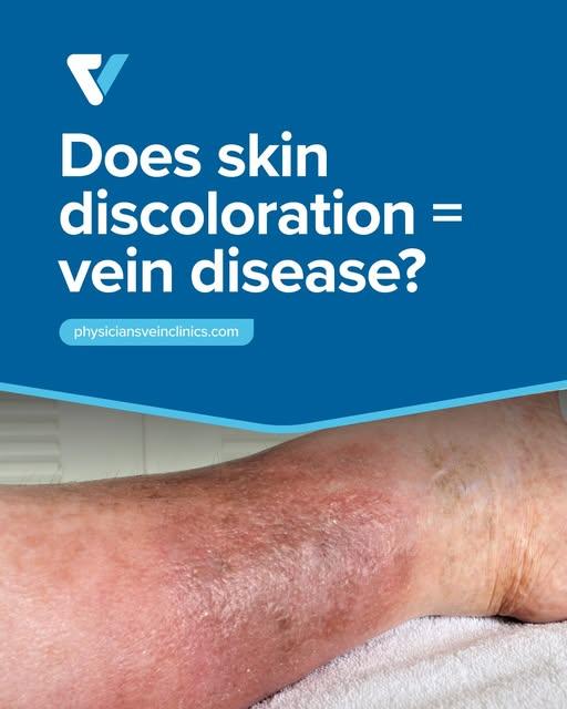 Images Physicians Vein Clinics
