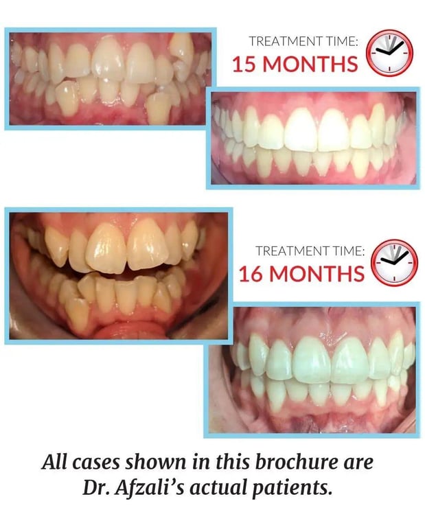 Images Lifetime Dental & Fastbraces