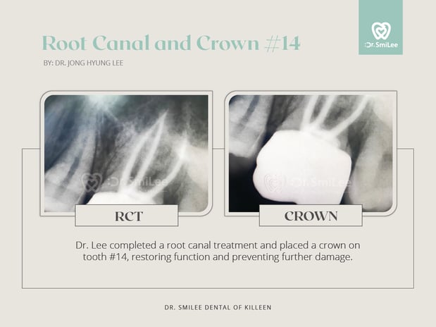 Images Dr Smilee Dental of Killeen, Family, Cosmetic, Implant, Medspa