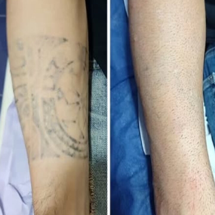 Images Medical Sthetic