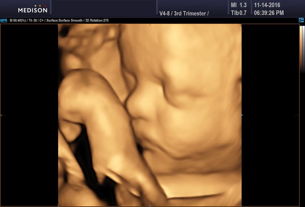 Images Heavenly 3D 4D Ultrasounds