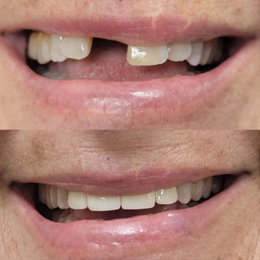 Images Advanced Dentistry & Implant Center