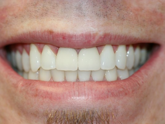 Images Martin Dentistry