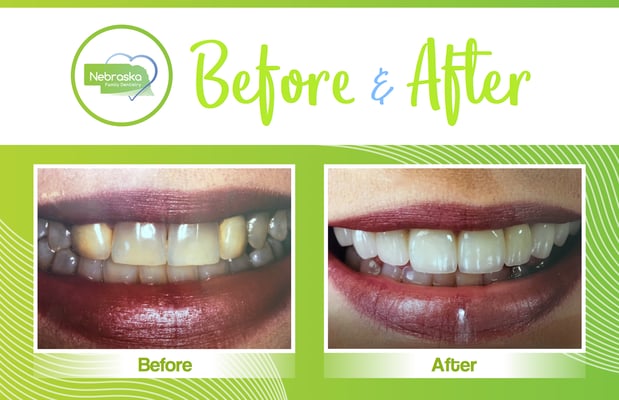 Images Lincoln Family Dentistry