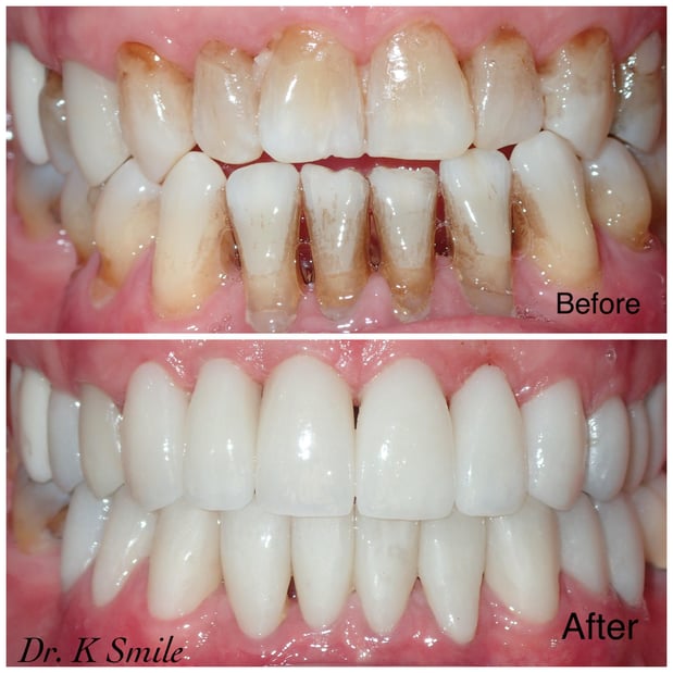 Images Reston Heights Dental