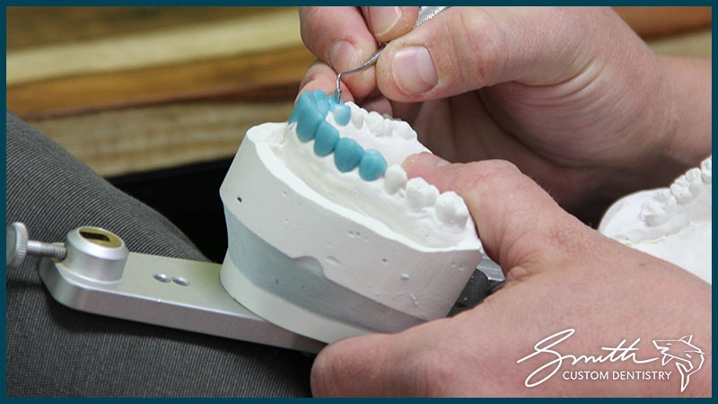 Images Smith Custom Dentistry