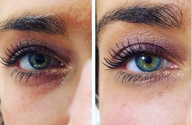 Images Renew Body Contouring & MedSpa