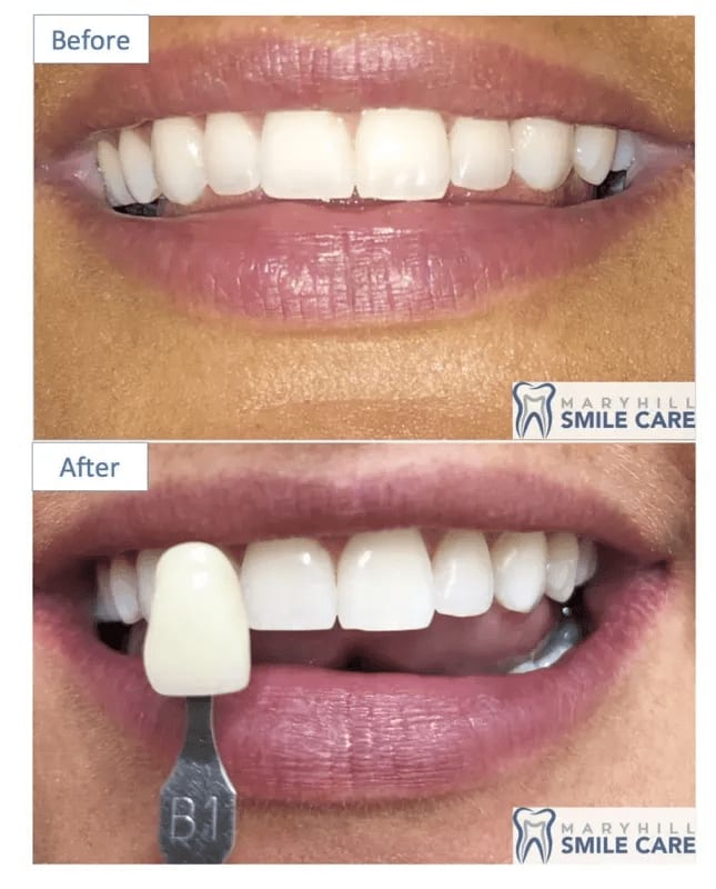 Images Maryhill Smile Care